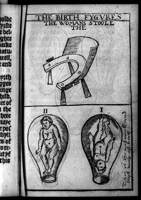 Woman's stool (birthing chair), fetus in uterus, feet down, and fetus in uterus, head down, latter marked "This is the naturall (sic) and best way of birth".