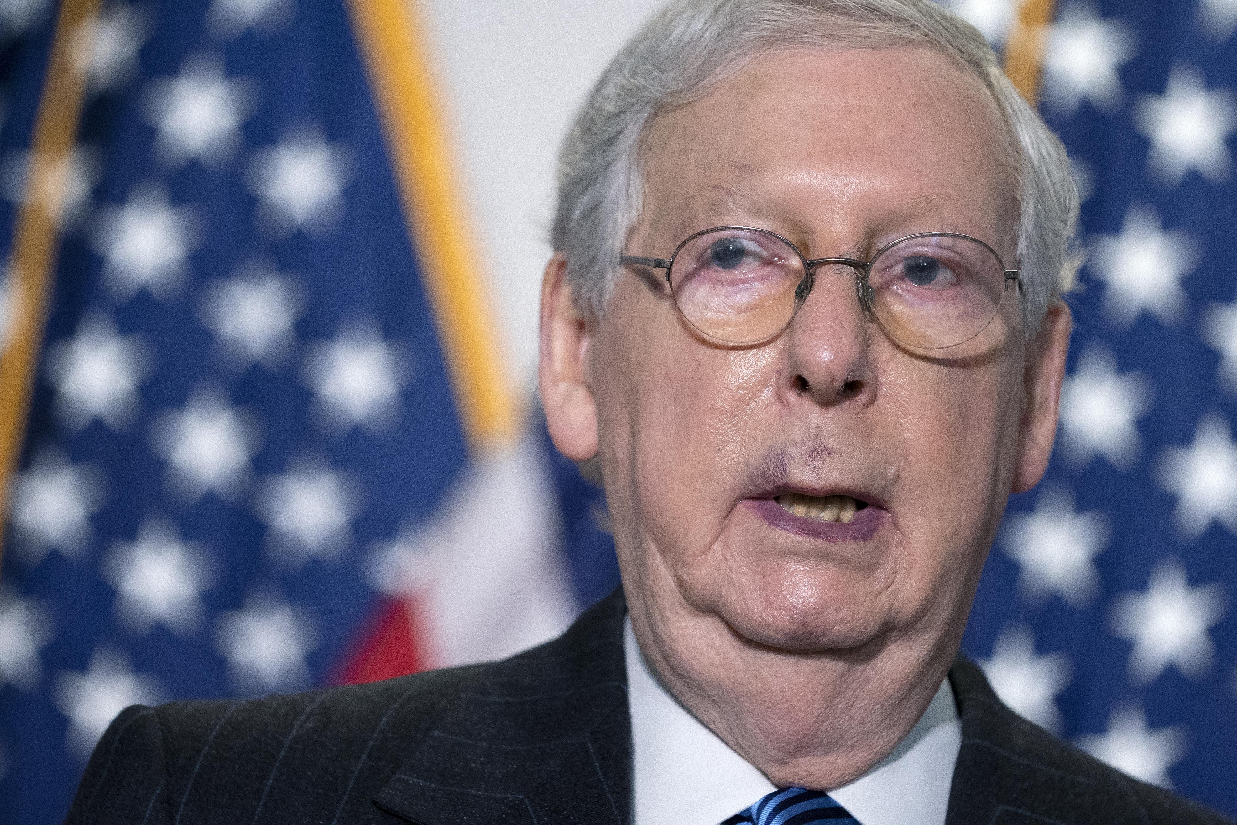 Close-up on Mitch McConnell's face, with bruising over his lip