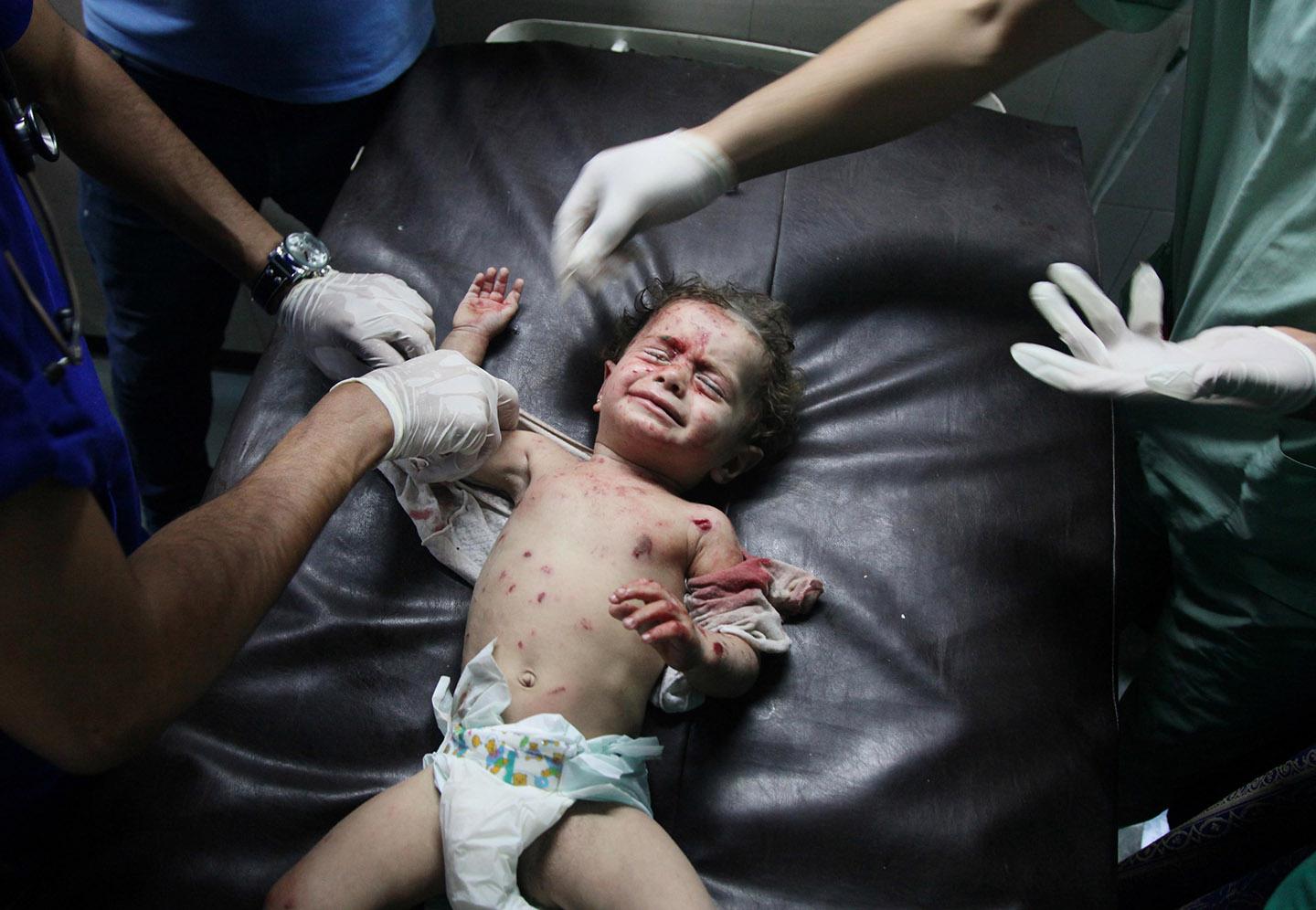 A Palestinian baby, injured in an Israeli airstrike.