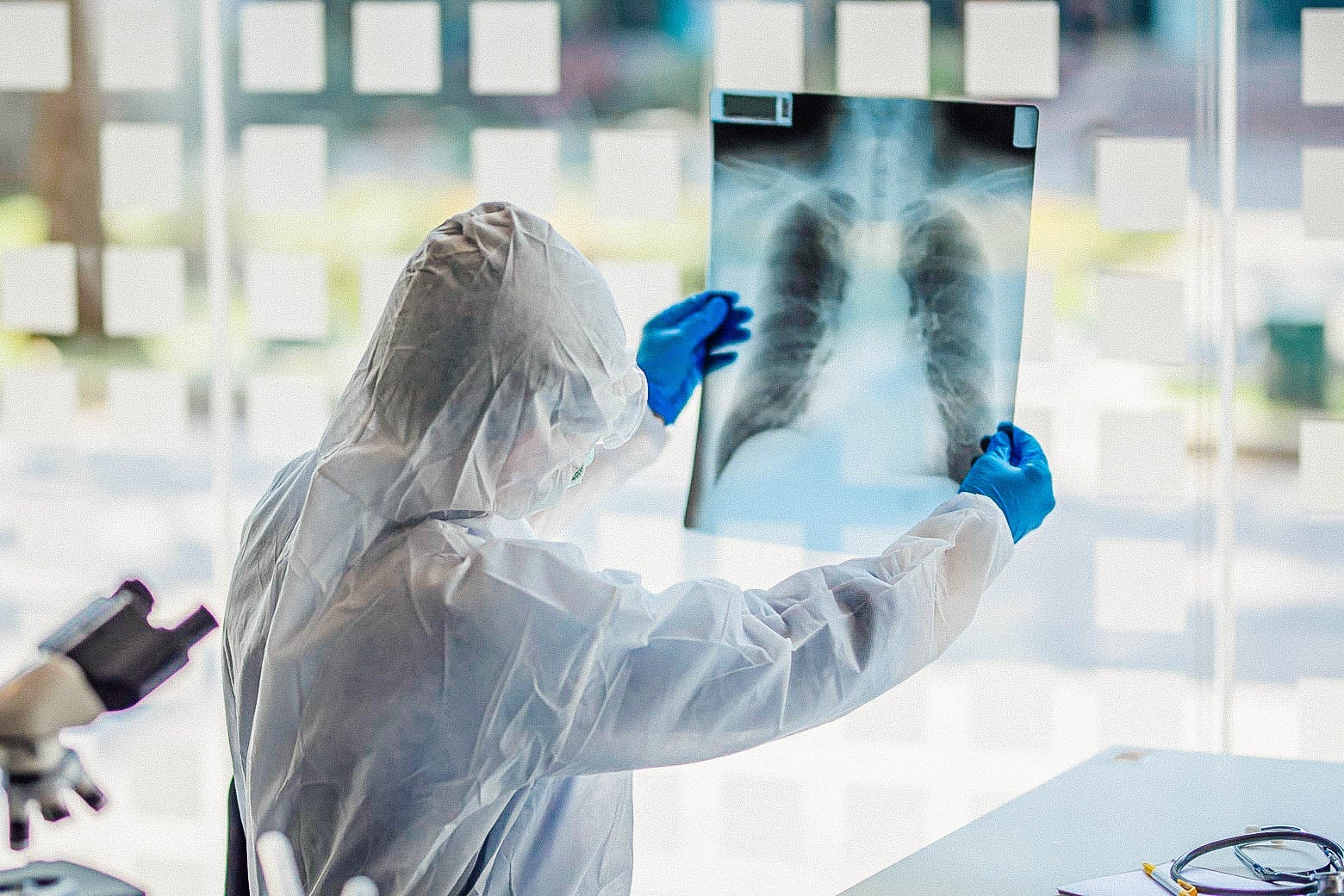 Doctor holding up an X-ray of someone's lungs.