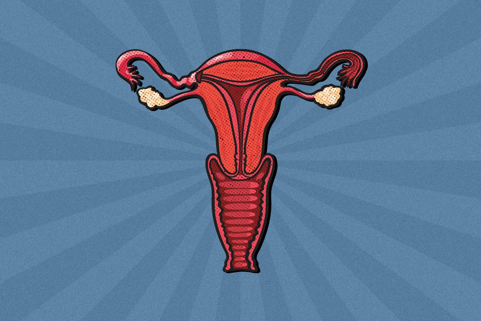 An illustration of a uterus.