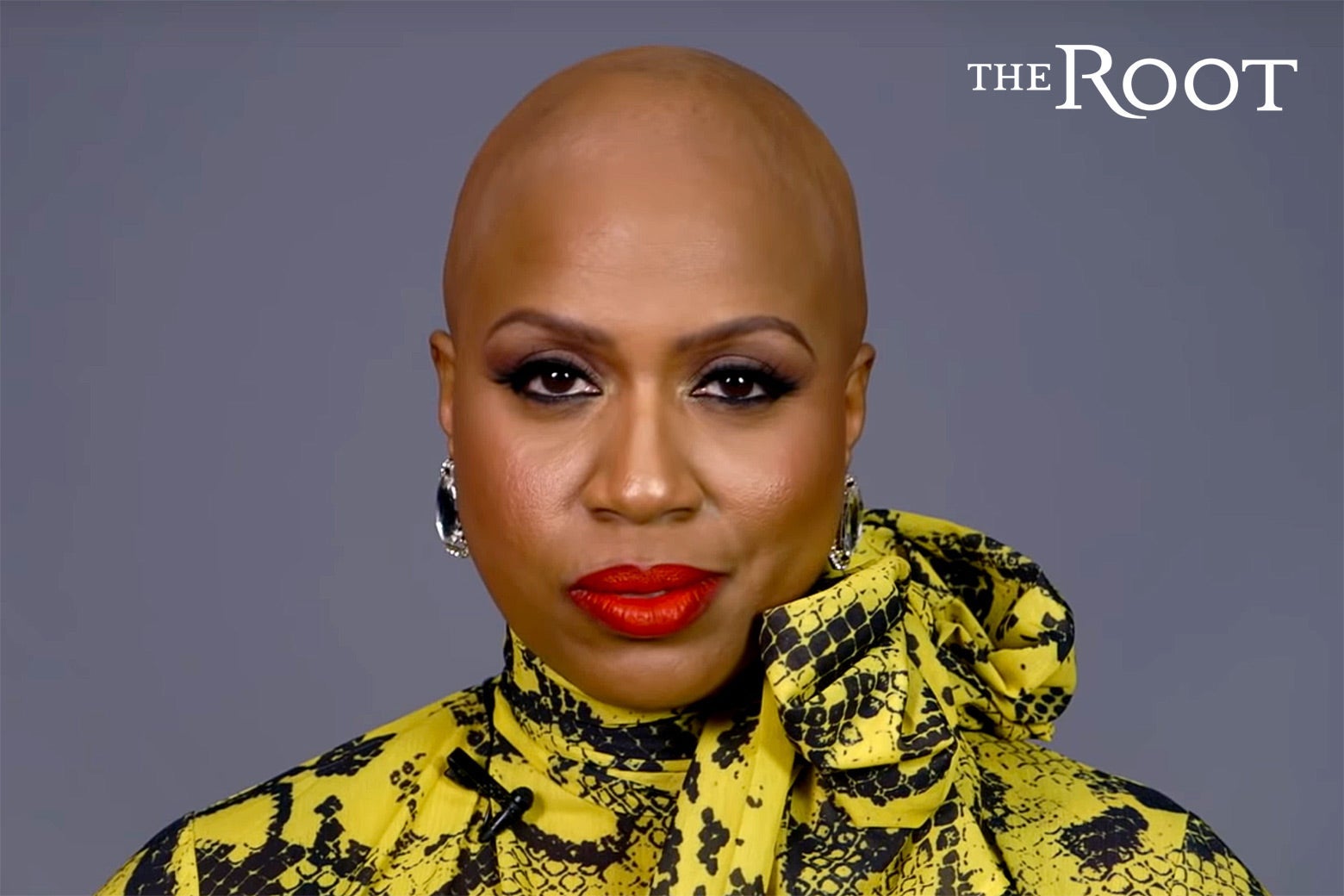 Ayanna Presley facing the camera, in a yellow and black patterned blouse, with her head fully bald.