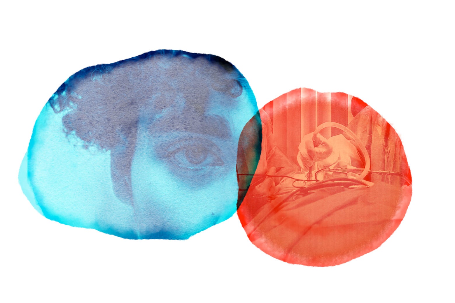 I&rsquo;m Getting No Sympathy For My Failed My Gender-Affirming Surgical Procedure