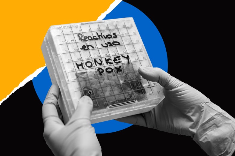 The Real Risks of Monkeypox The Real Risks of Monkeypox