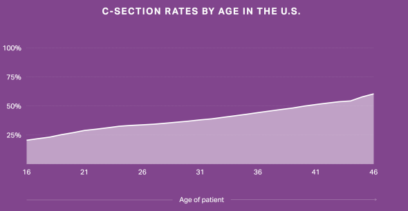 Why the C-section rate is much higher than it should be in US