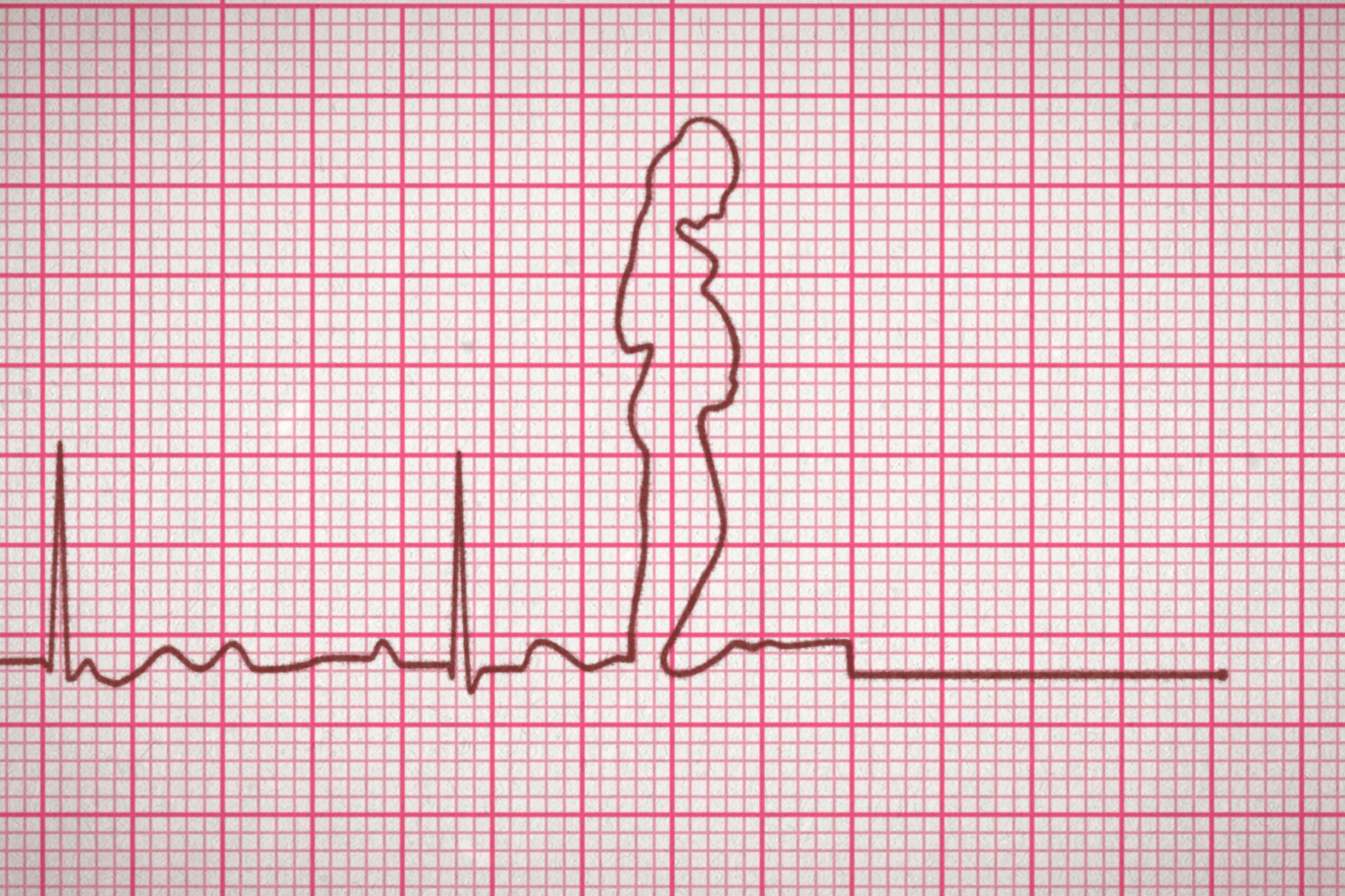 The spike of a heartbeat rendered on an EKG.
