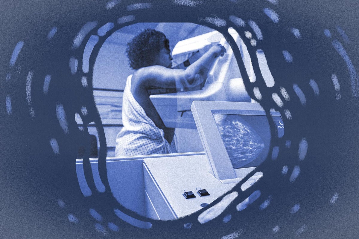It’s the Gold Standard of Early Cancer Detection. For 40 Percent of Women, It Doesn’t Work.