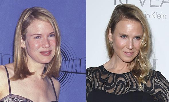 Renee Zellweger Plastic Surgery In Hollywood Women Over 40 Get A New Face Or Disappear