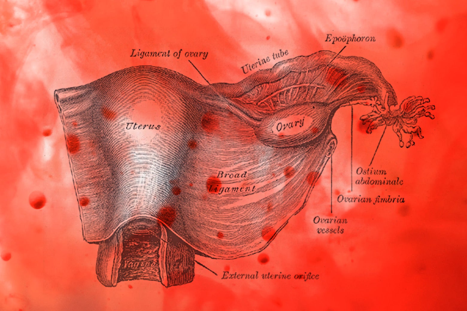 A medical diagram of the uterus, vagina and ovaries.