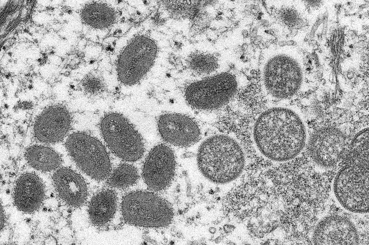 An electron microscopic image shows mature, oval-shaped monkeypox virus particles.