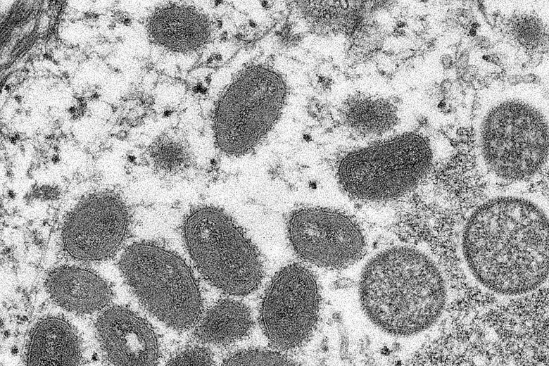 Monkeypox? Really!? Monkeypox? Really!?