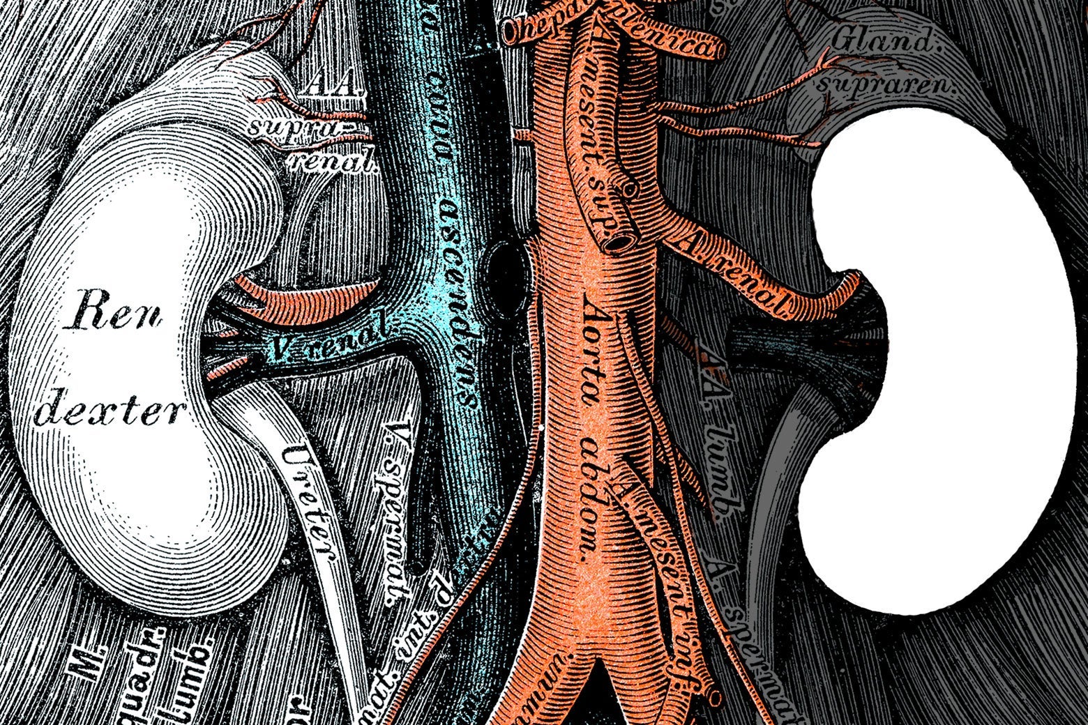 The race-based adjustment for kidney functioning that's harming Black Americans. - Vimarsana News