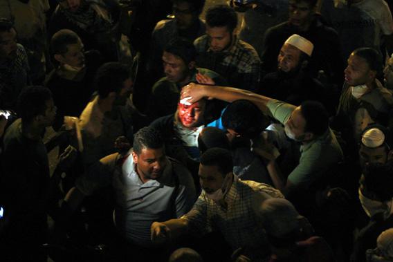 An injured supporter of deposed Egyptian President Mohamed Mursi is helped during clashes with riot police on the Sixth of October Bridge over the Ramsis square area in central Cairo.