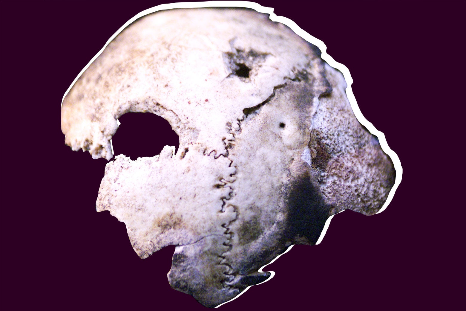 A skull fragment.