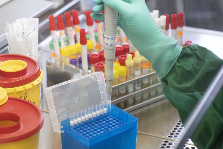 U.S. limited coronavirus testing because it didn’t have enough tests.