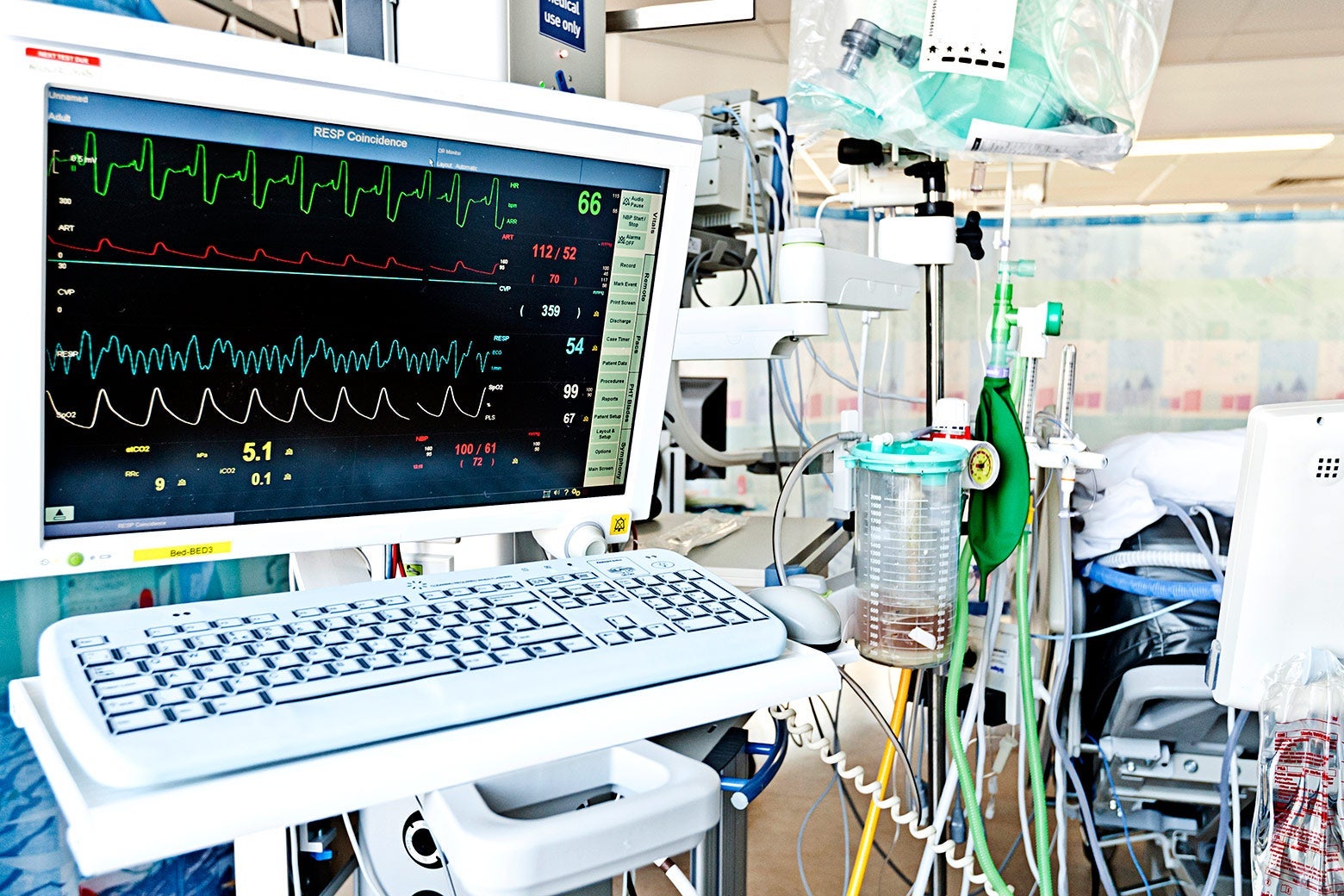 ICU machines and wires