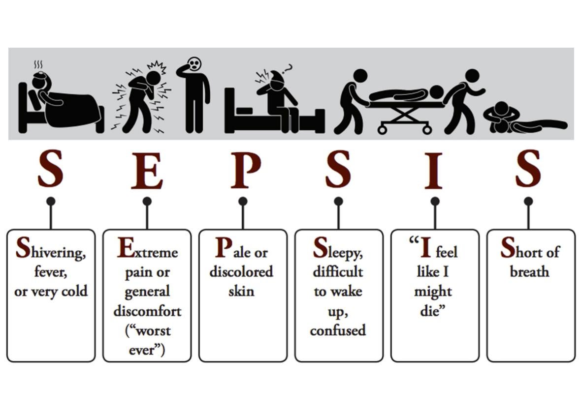 sepsis chart. 