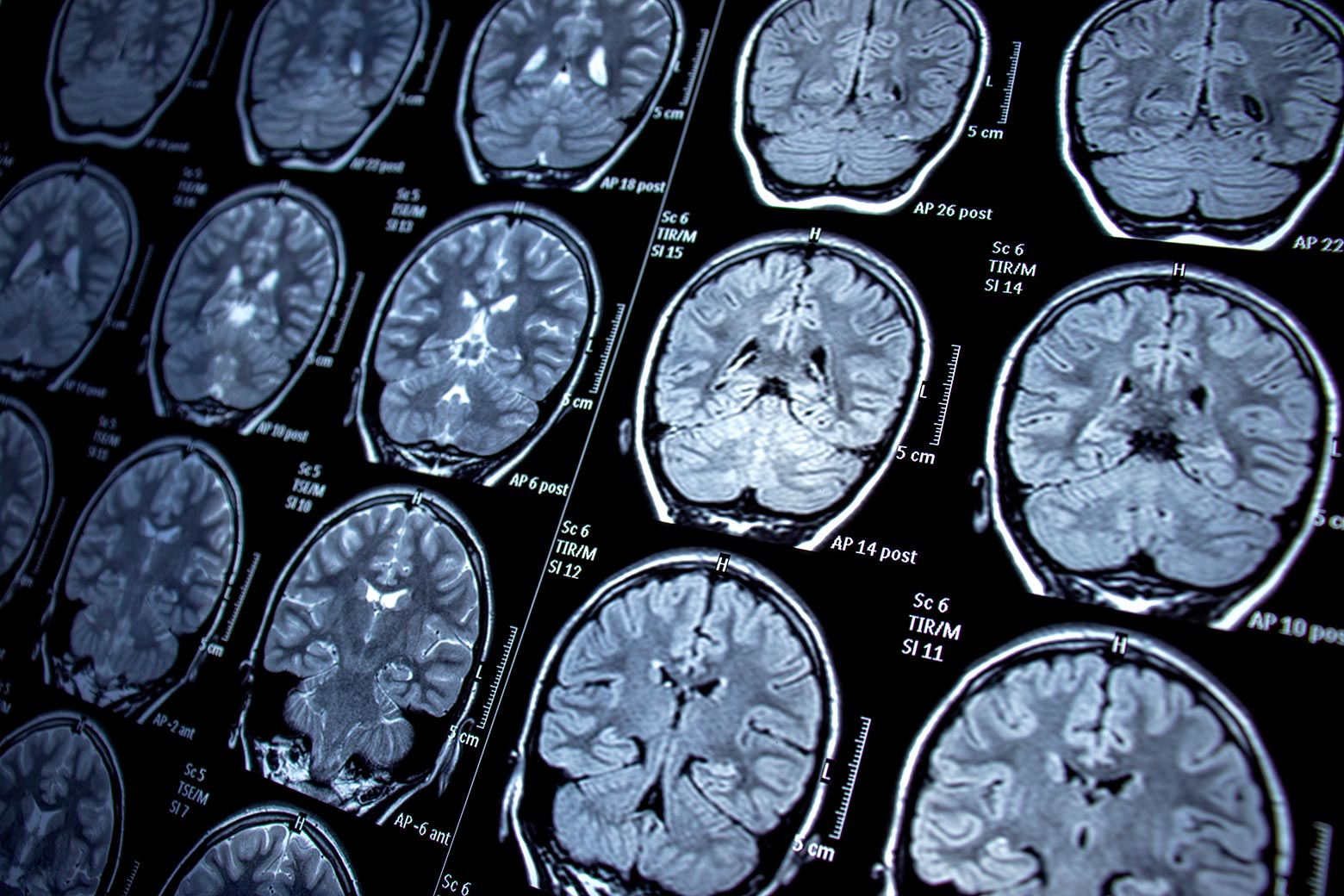 Brain scans.