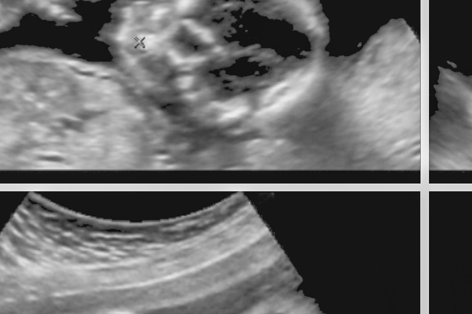 A collage of sonograms.