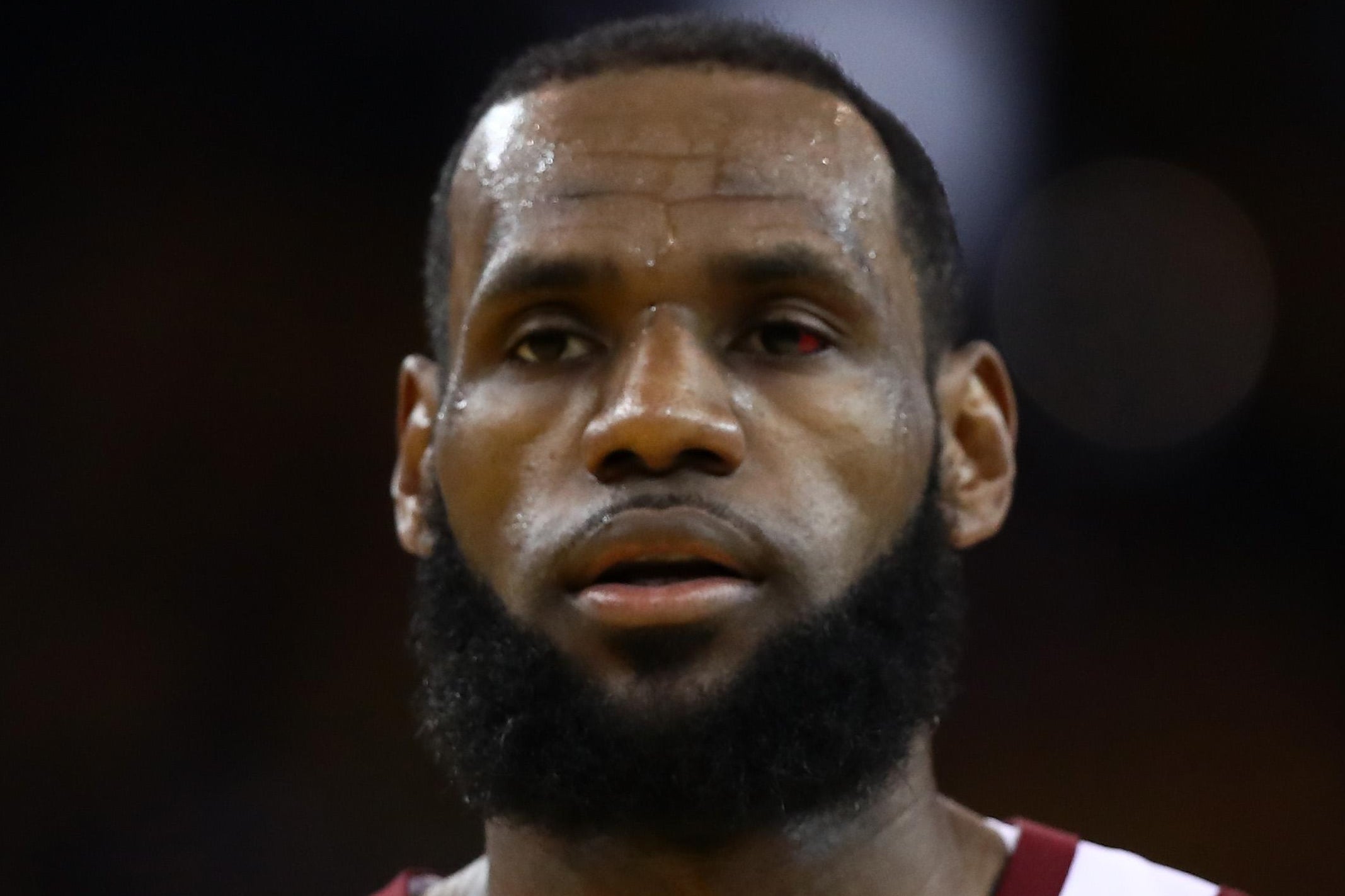 LeBron James' left eye looks very red and gross.