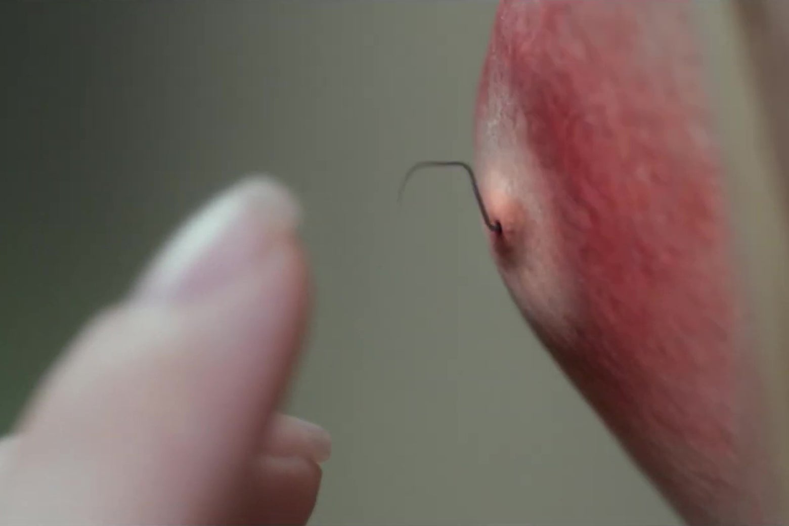 An extreme close up of what appears to be a pimple, except a spider's leg is emerging from under the skin.