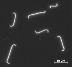 Image of leptospirosis.