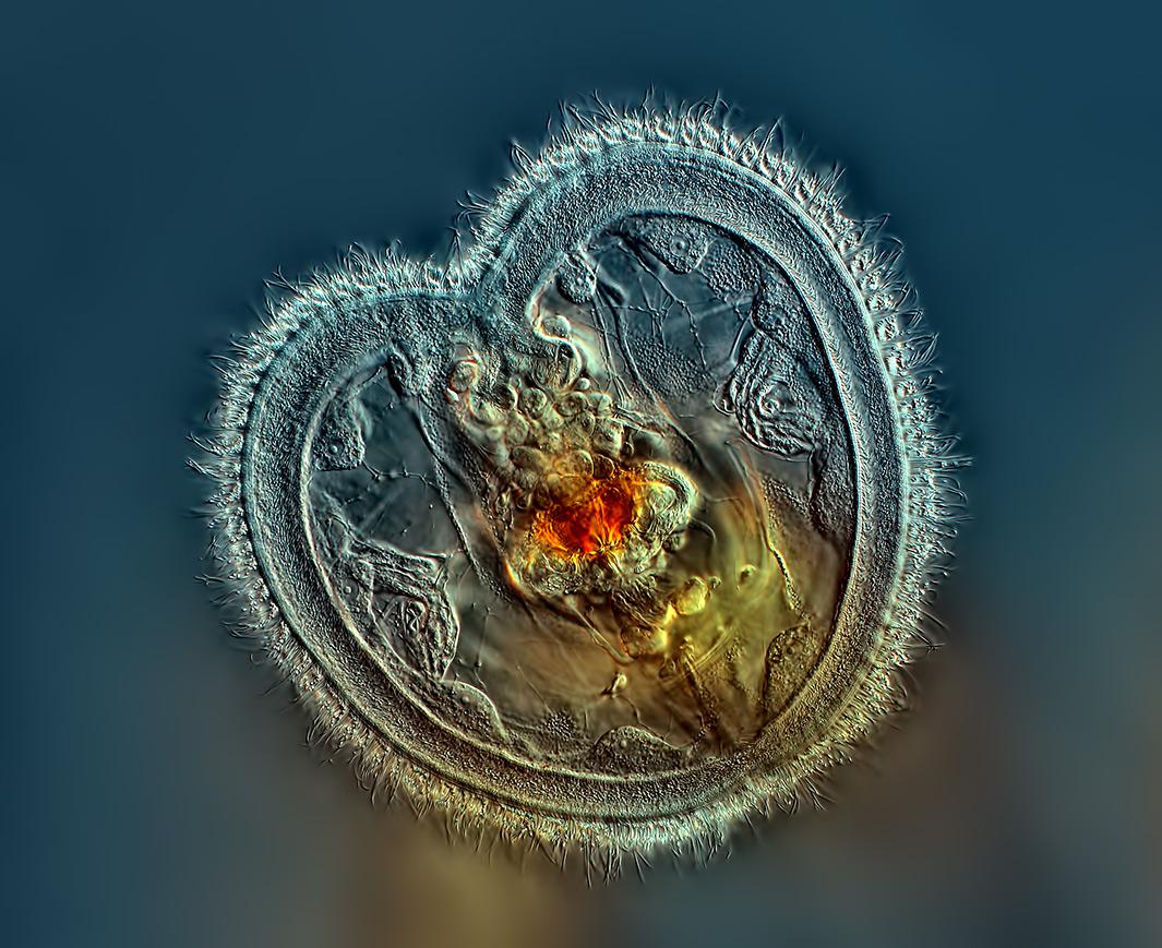 Rotifer showing the mouth interior and heart shaped corona using a technique known as Differential Interference Contrast, 40X.