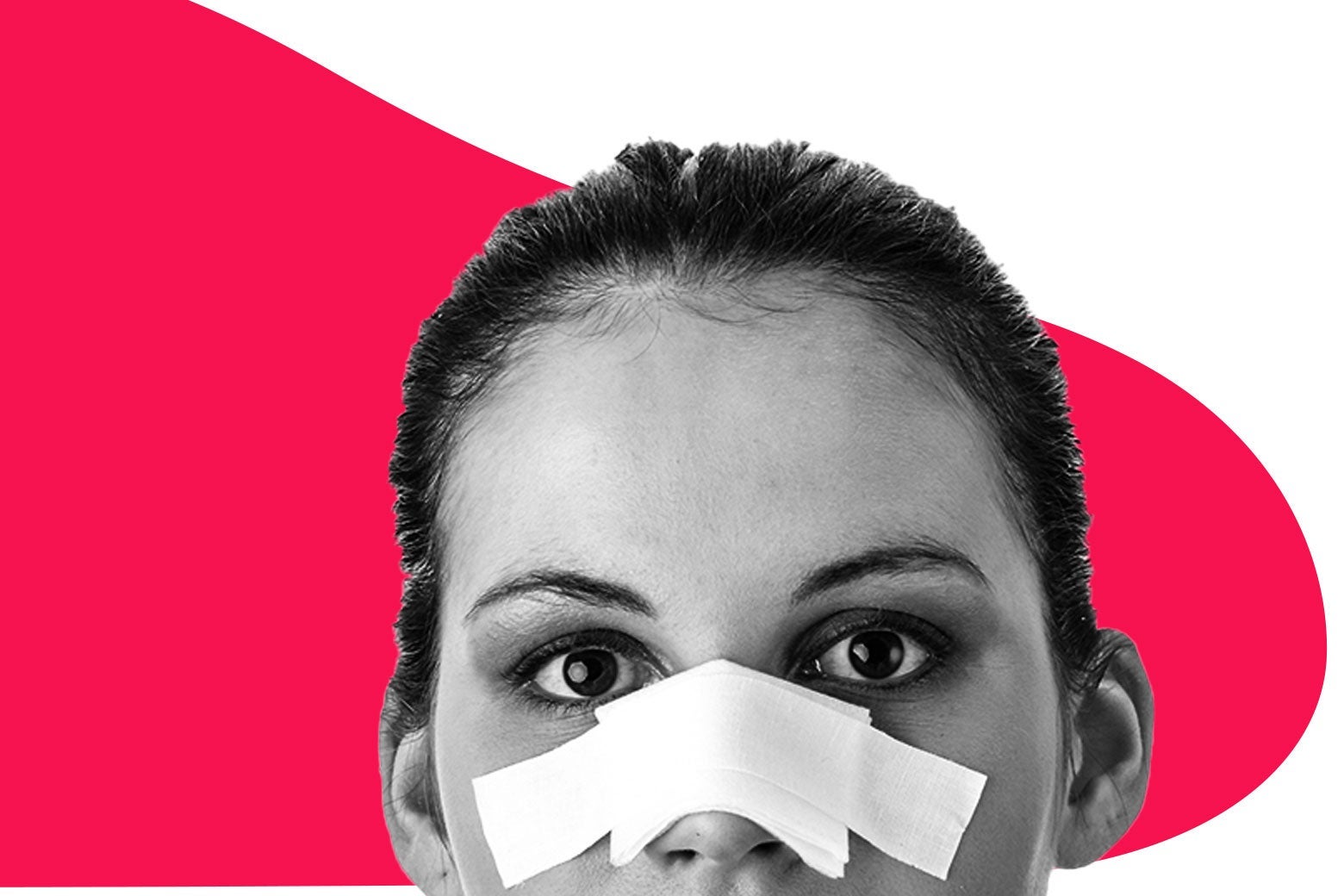 Photo of a woman with a bandage over her nose.