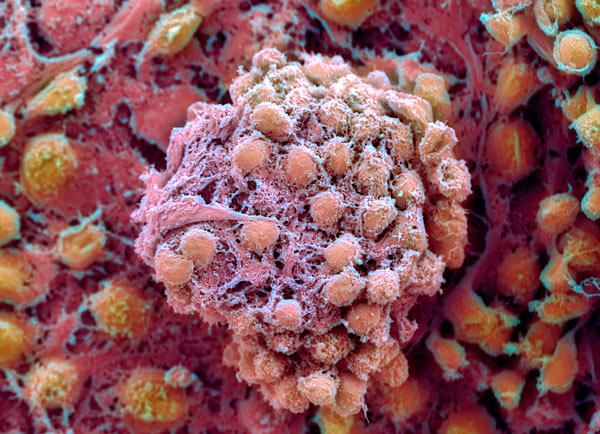 Colored scanning electron micrograph of human embryonic stem cells.
