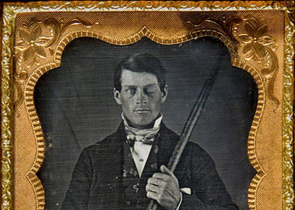 Cased-daguerreotype portrait of Phineas P. Gage holding the tamping iron that injured him.