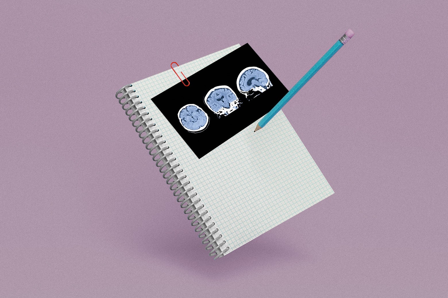 Three images of brain scans are paper-clipped to a notebook; a pencil hovers over it. 