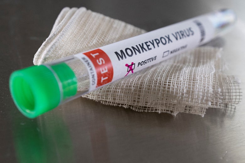 A test tube labeled "Monkeypox Virus" with an X in the box next to "positive."