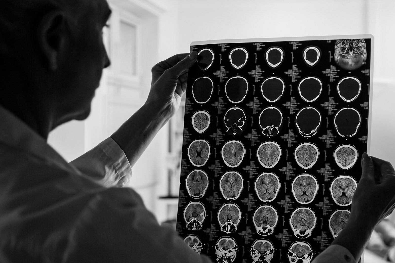 A doctor looks at brain scans.