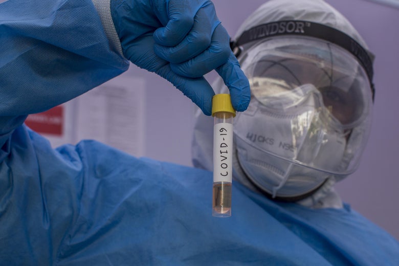 A laboratory technician from Dr. Dangs Lab holds a coronavirus testing tube at a drive-through testing service on April 07, 2020 in New Delhi, India. 