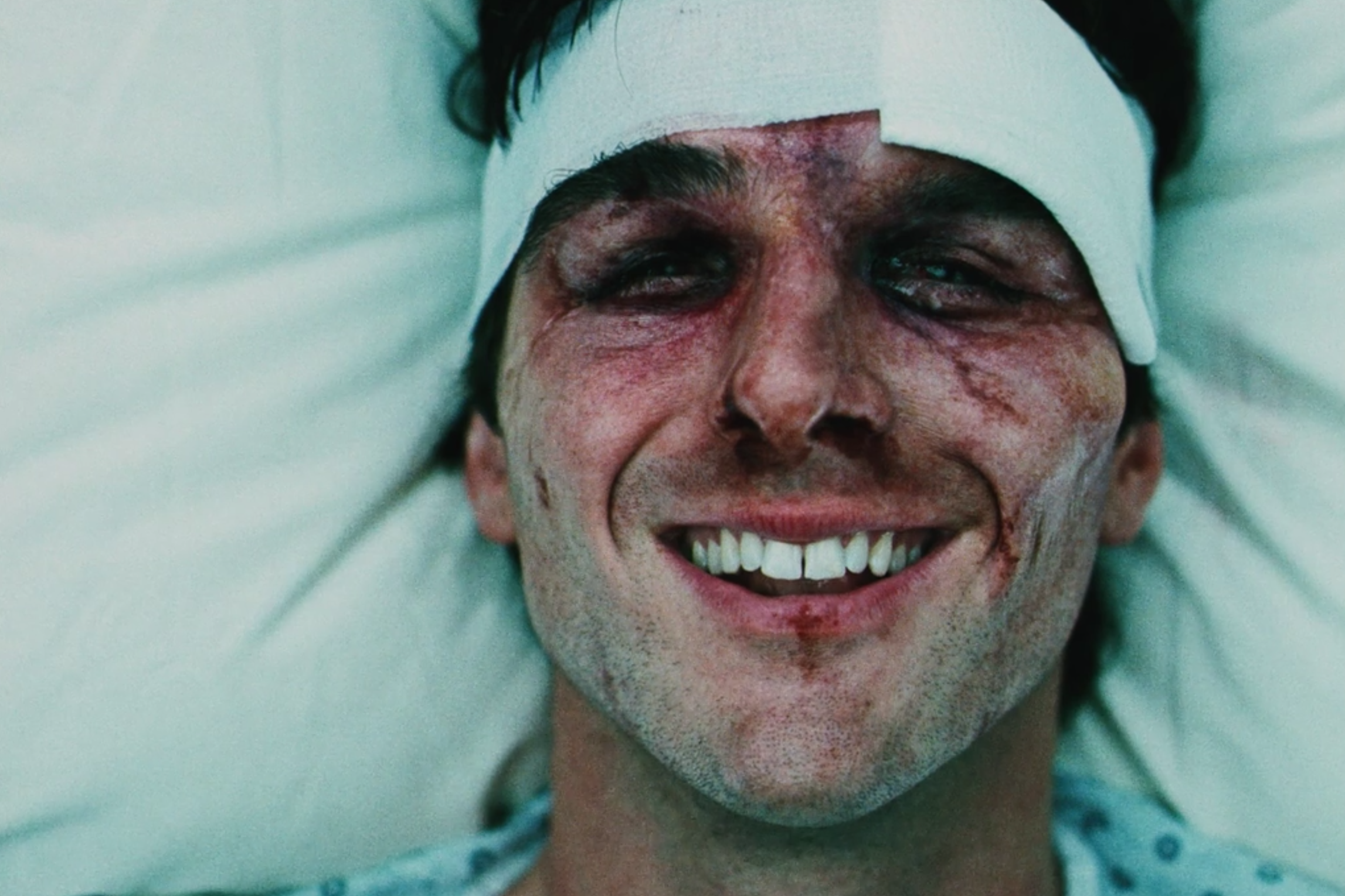 A boy in a hospital gown and with a bandage around his head smiles. His eyes are completely swollen.