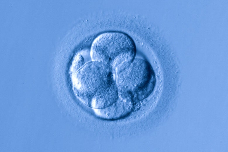 A human egg cell.