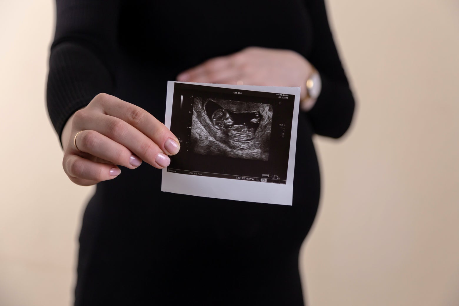 Roe v. Wade How our understanding of pregnancy has changed throughout