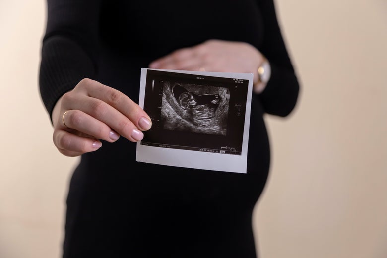 A visibly pregnant person wearing black, holding a photo of an ultrasound in front of their belly. 