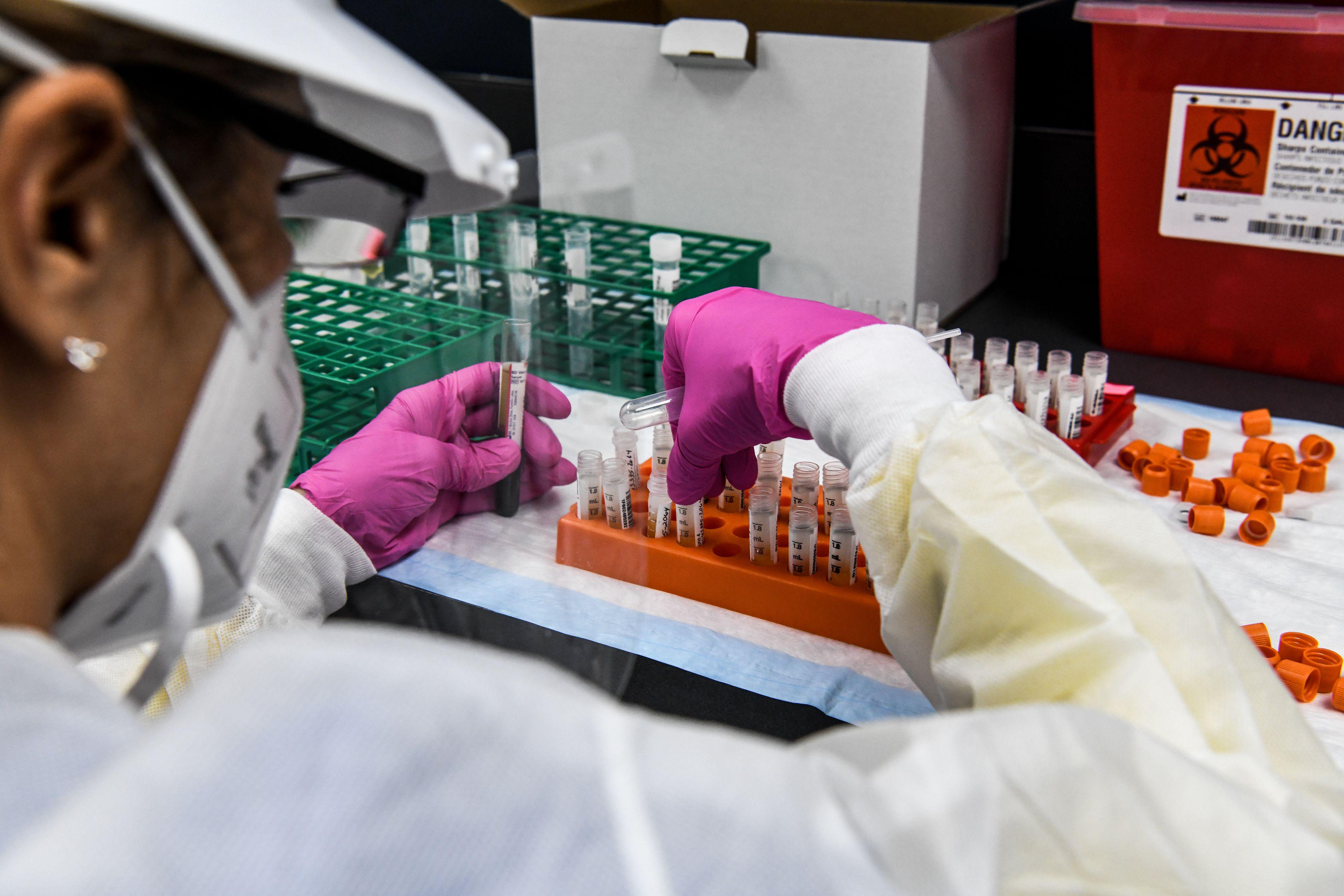 A lab technician sorts blood samples inside a lab for a COVID-19 vaccine study.