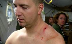 Staff Sgt. Richard "Doc" Blakley's sniper wound