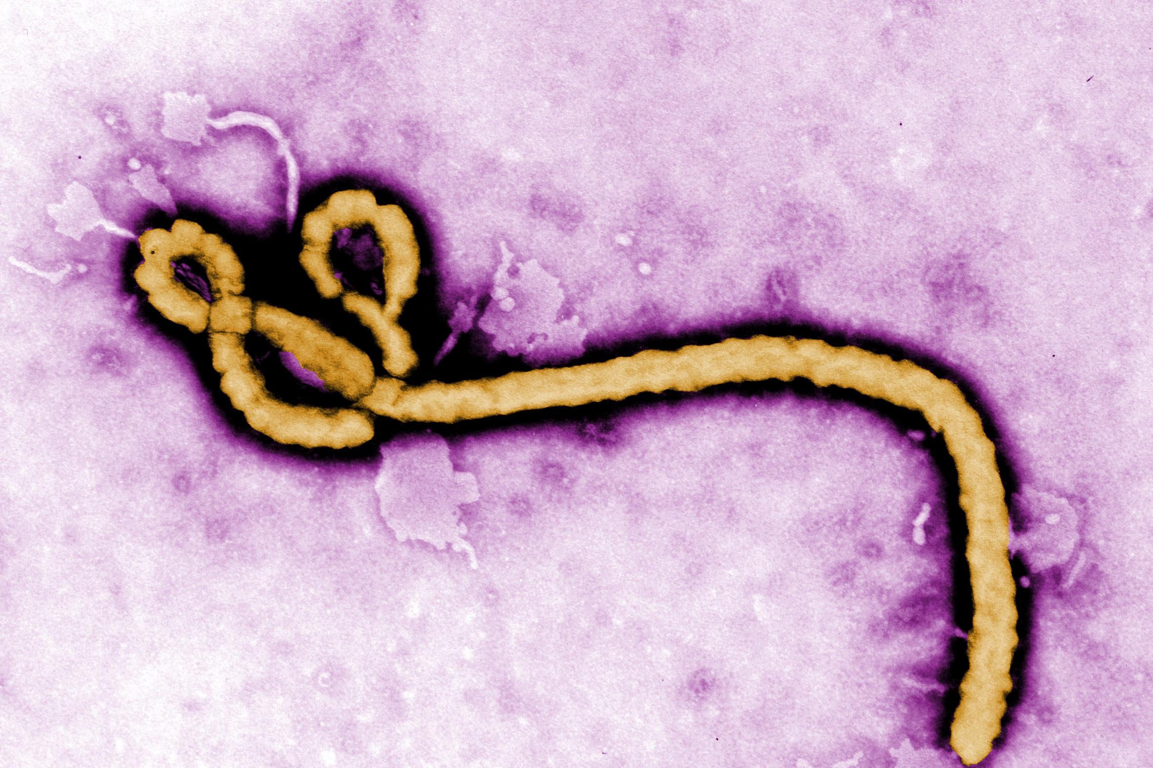 A micrograph of an Ebola virus