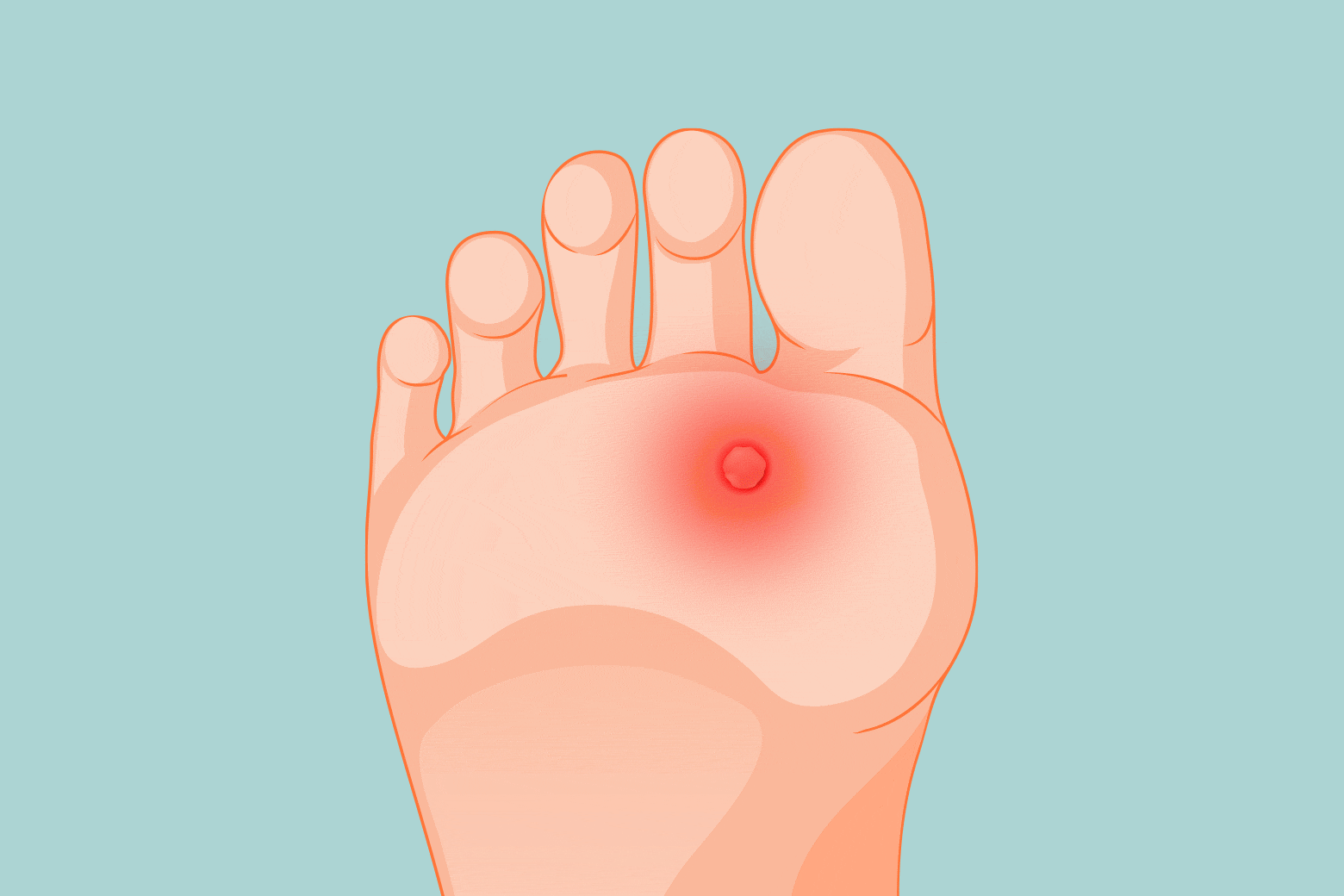 A pulsing red wart on an animated foot