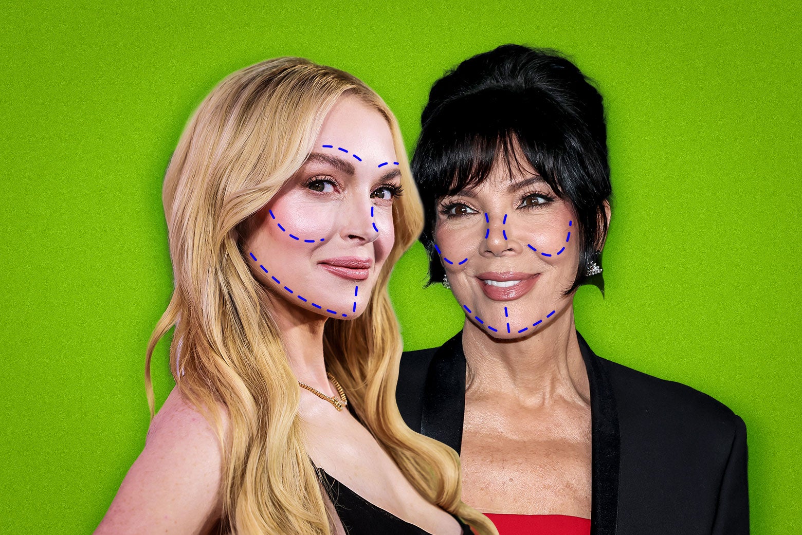 I&rsquo;m 32. I Can&rsquo;t Wait to Get a Face-Lift.