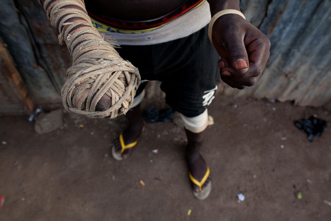 Lagos, Nigeria- Dambe boxer 'Shago' Jango, 25, displays the "spear", or striking arm wrapped in rope or material, and the "shield" or blocking arm in Lagos, Nigeria.