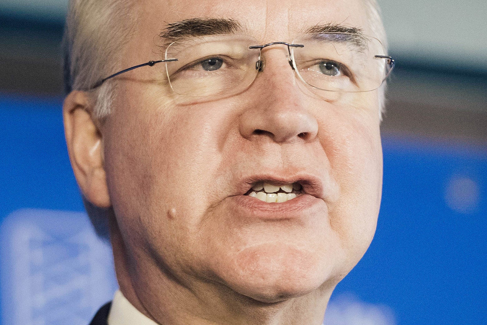 Tom Price.