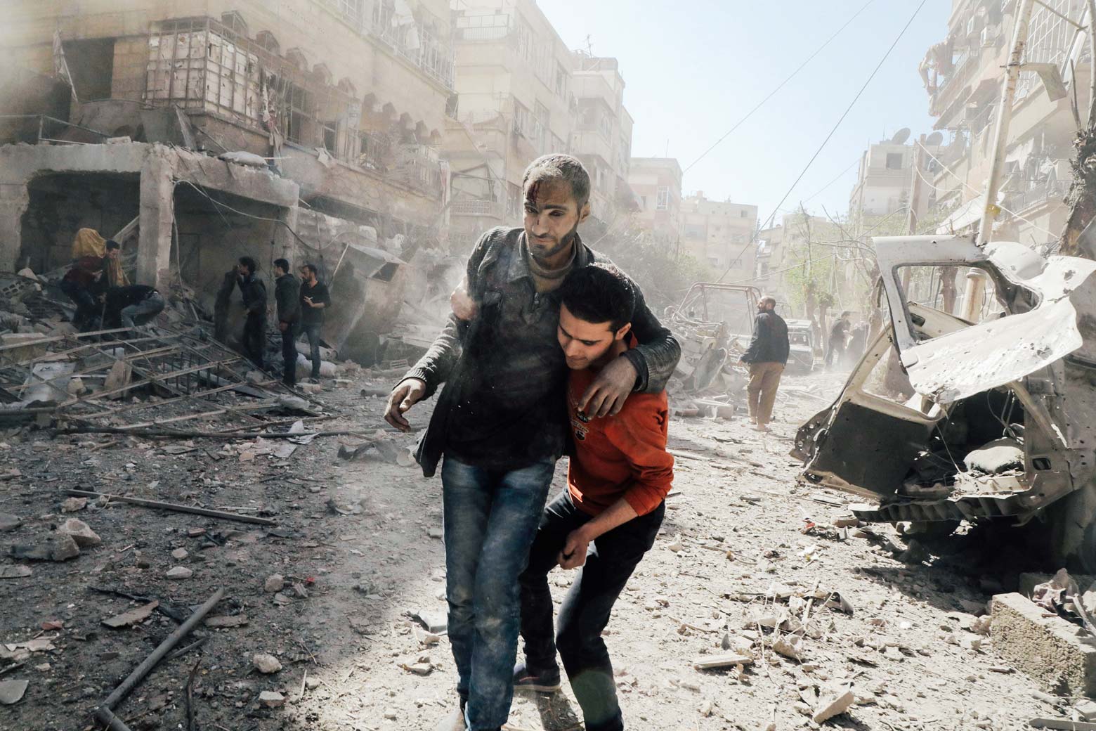 A Syrian man helps evacuate an injured victim following Syrian government air strikes on the Eastern Ghouta rebel-held enclave of Douma, on the outskirts of the capital Damascus on March 20, 2018.