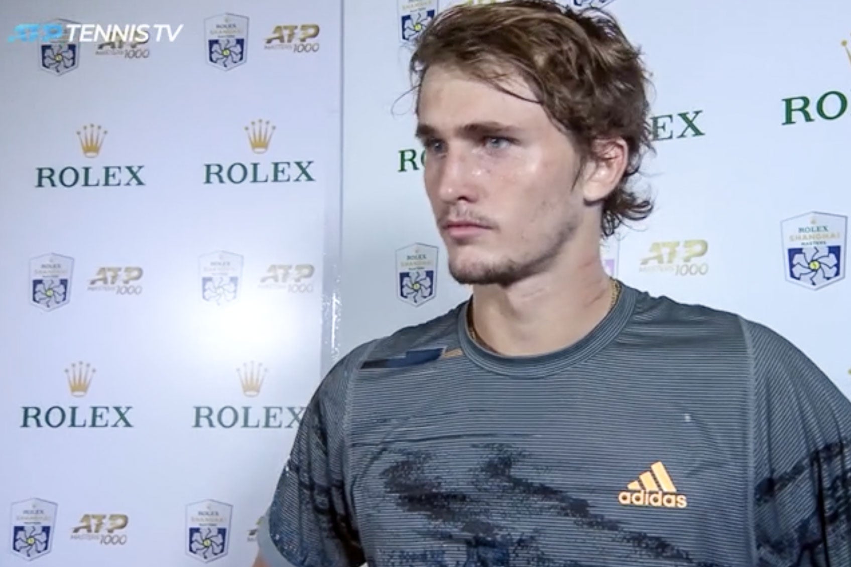Zverev standing with his face slightly turned, showing red markings on his neck
