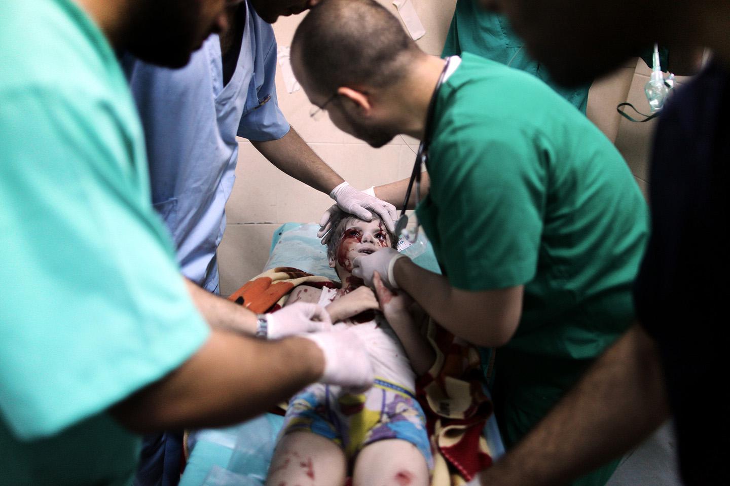 Doctors treat a Palestinian kid, who was injured in an Israeli attack.