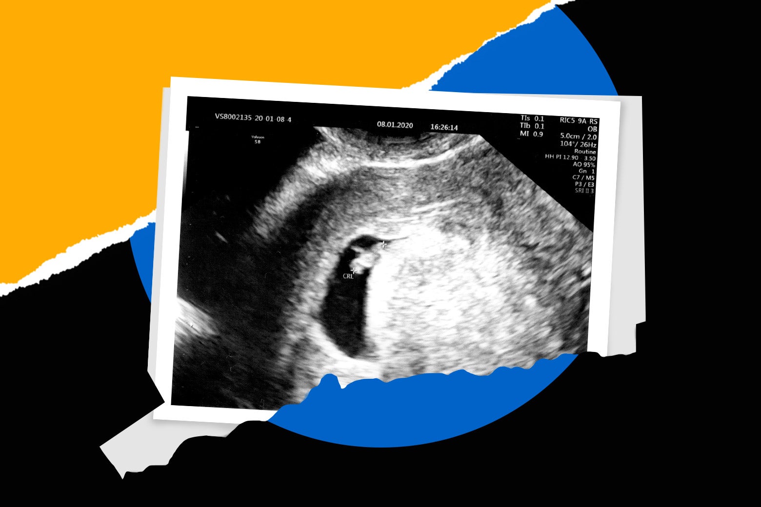 How Connecticut Became An Abortion Safe Haven