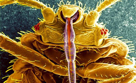 This digitally-colorized scanning electron micrograph (SEM) revealed some of the ultrastructural morphology displayed on the ventral surface of a bedbug, Cimex lectularius.